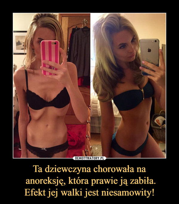 Ta dziewczyna chorowała na
 anoreksję, która prawie ją zabiła.
Efekt jej walki jest niesamowity!