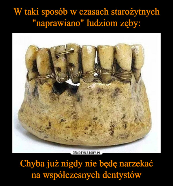 W taki sposób w czasach starożytnych "naprawiano" ludziom zęby: Chyba już nigdy nie będę narzekać
na współczesnych dentystów