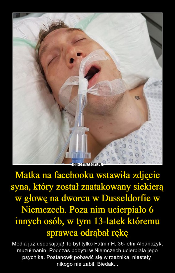 Matka na facebooku wstawiła zdjęcie syna, który został zaatakowany siekierą w głowę na dworcu w Dusseldorfie w Niemczech. Poza nim ucierpiało 6 innych osób, w tym 13-latek któremu sprawca odrąbał rękę