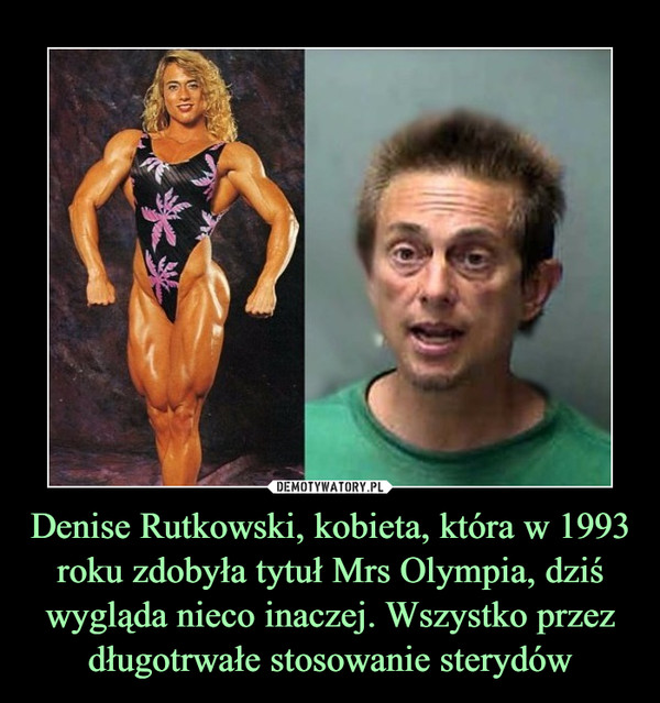Denise Rutkowski, kobieta, która w 1993 roku zdobyła tytuł Mrs Olympia, dziś wygląda nieco inaczej. Wszystko przez długotrwałe stosowanie sterydów