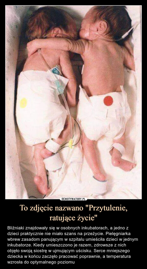To zdjęcie nazwano "Przytulenie, ratujące życie'' – Bliźniaki znajdowały się w osobnych inkubatorach, a jedno z dzieci praktycznie nie miało szans na przeżycie. Pielęgniarka wbrew zasadom panującym w szpitalu umieściła dzieci w jednym inkubatorze. Kiedy umieszczono je razem, zdrowsze z nich objęło swoją siostrę w ujmującym uścisku. Serce mniejszego dziecka w końcu zaczęło pracować poprawnie, a temperatura wzrosła do optymalnego poziomu Bliźniaki znajdowały się w osobnych inkubatorach, a jedno z dzieci praktycznie nie miało szans na przeżycie. Pielęgniarka wbrew zasadom panującym w szpitalu umieściła dzieci w jednym inkubatorze. Kiedy umieszczono je razem, zdrowsze z nich objęło swoją siostrę w ujmującym uścisku. Serce mniejszego dziecka w końcu zaczęło pracować poprawnie, a temperatura wzrosła do optymalnego poziomu