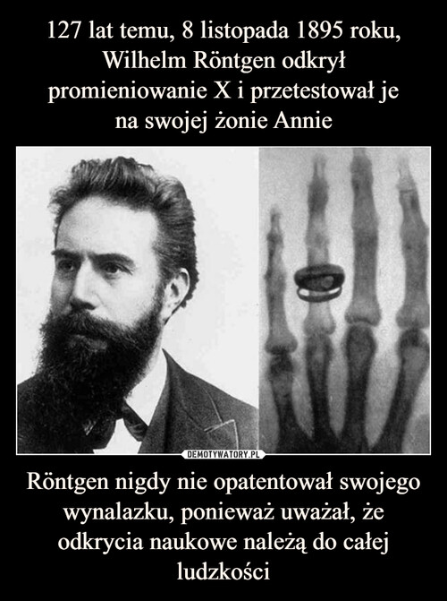 127 lat temu, 8 listopada 1895 roku, Wilhelm Röntgen odkrył promieniowanie X i przetestował je
na swojej żonie Annie Röntgen nigdy nie opatentował swojego wynalazku, ponieważ uważał, że odkrycia naukowe należą do całej ludzkości