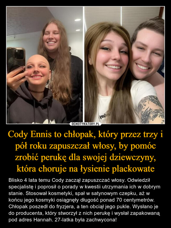 Cody Ennis to chłopak, który przez trzy i pół roku zapuszczał włosy, by pomóc zrobić perukę dla swojej dziewczyny, która choruje na łysienie plackowate